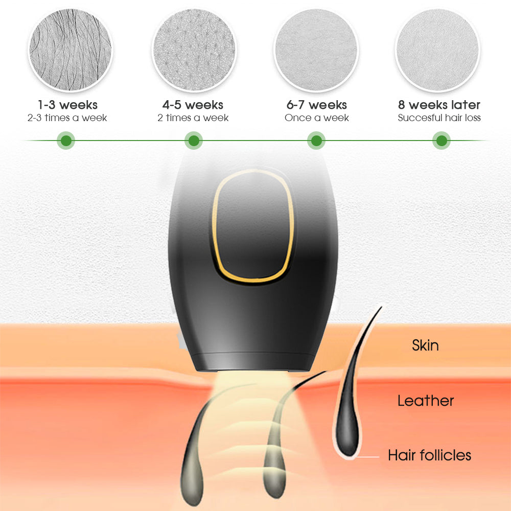 Cindarello Luminous Pulse™ IPL Hair-Reduction Device — 500,000 Flashes | Cindarello Selection